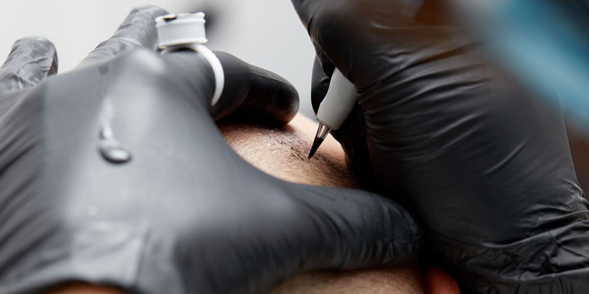 Tricopigmentation